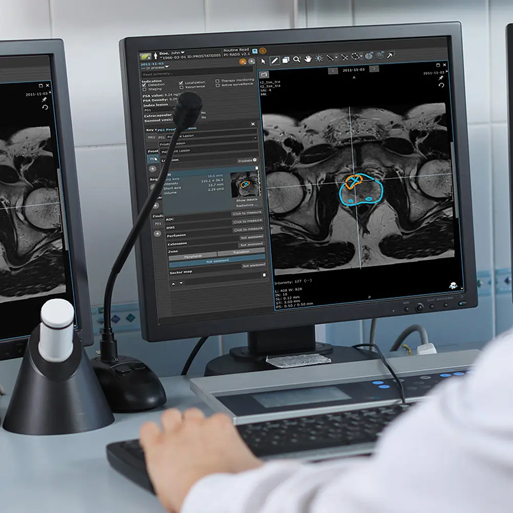 Bildschirmansicht MRT Prostata