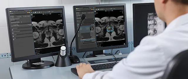 Bildschirmansicht MRT Prostata