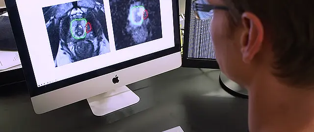 Ausschnitt des Films mit MRT-Aufnahmen der Prostata
