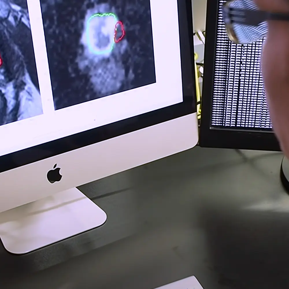 Ausschnitt des Films mit MRT-Aufnahmen der Prostata