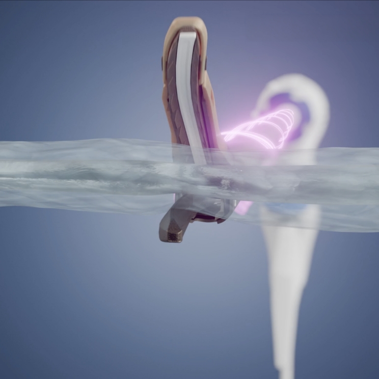 3D-Rendering Detailaufnahme des medizinischen Produkts Thunderbeat II von Olympus aus Produktfilm